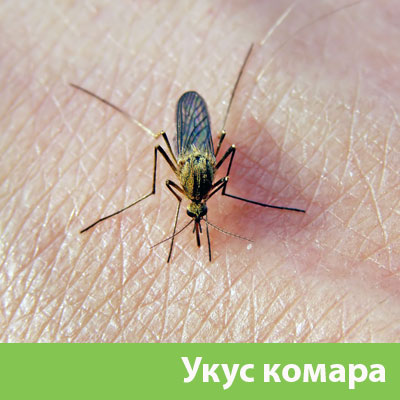 Укусы комаров в Кемерово