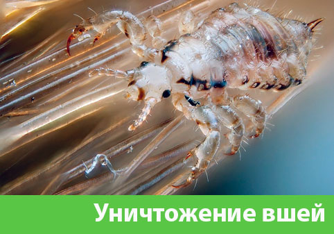 Уничтожение вшей в городе Кемерово